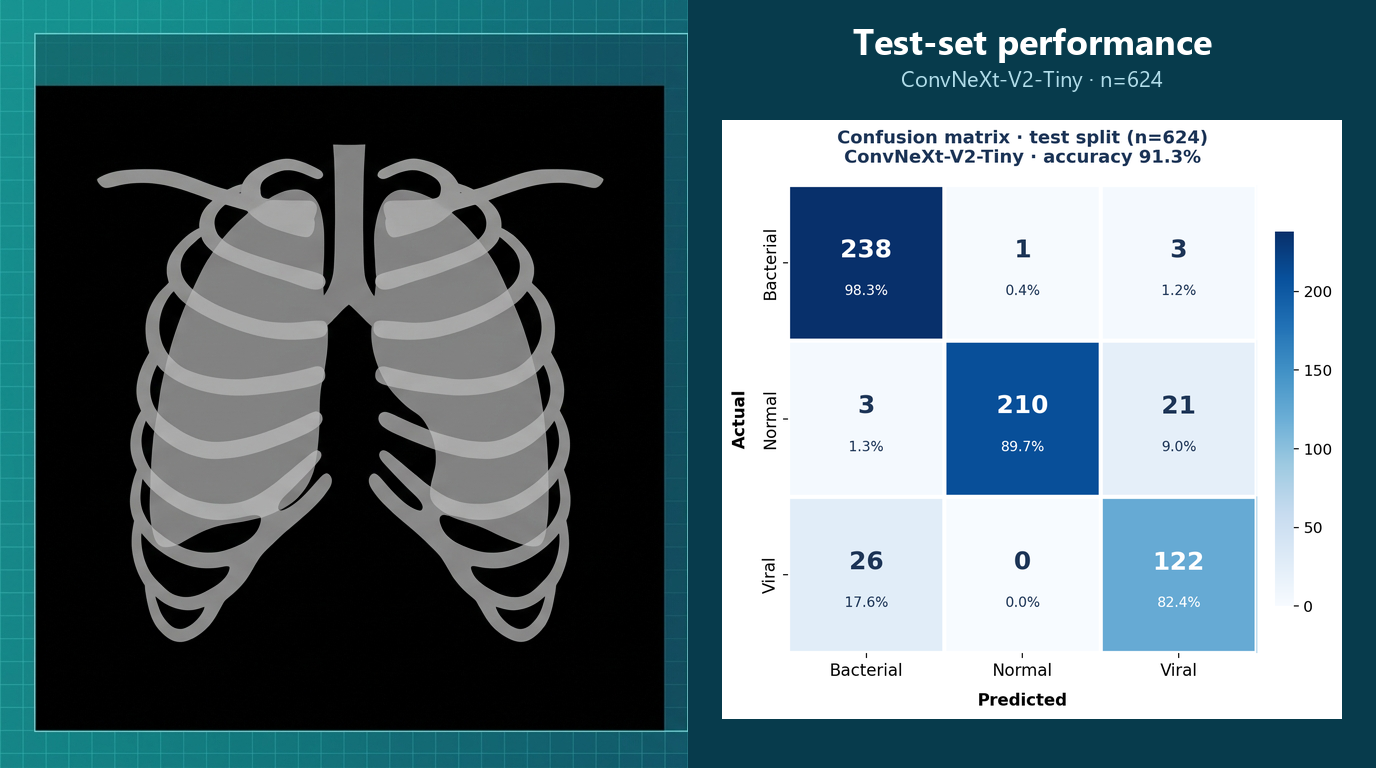 chest-xray-classifier · ConvNeXt-V2-Tiny pneumonia classifier