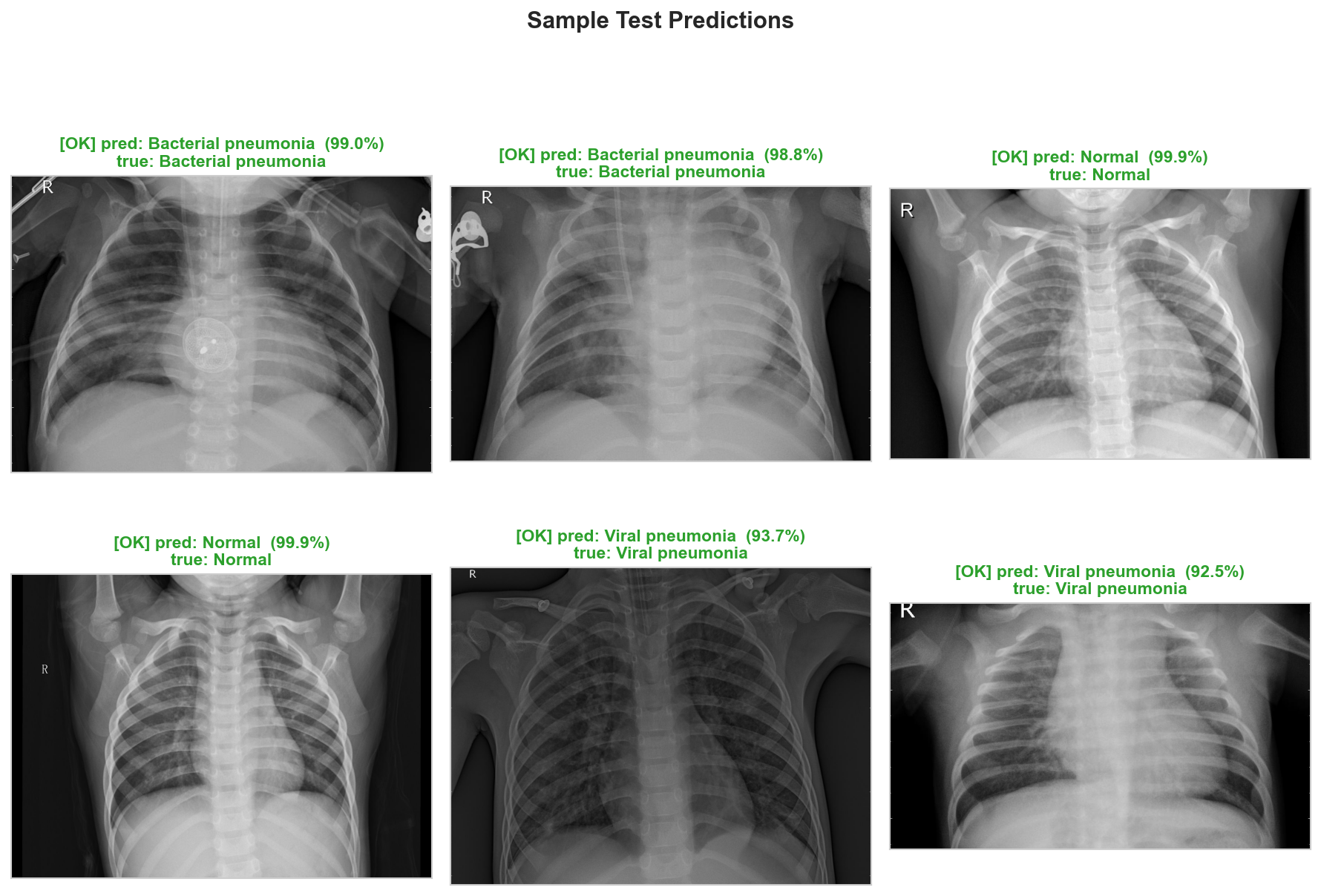 Sample predictions on test radiographs